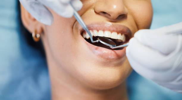 Best Tooth Pain Emergency Relief  in La Blanca, TX