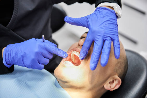 Best Chipped Tooth Repair Near Me  in La Blanca, TX